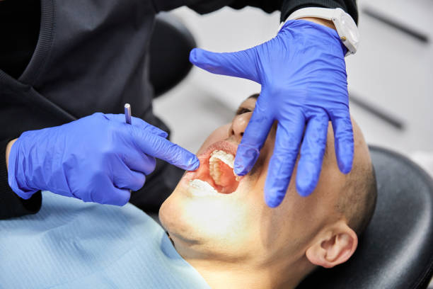 Best Emergency Dental Extractions in Rkesburg, PA